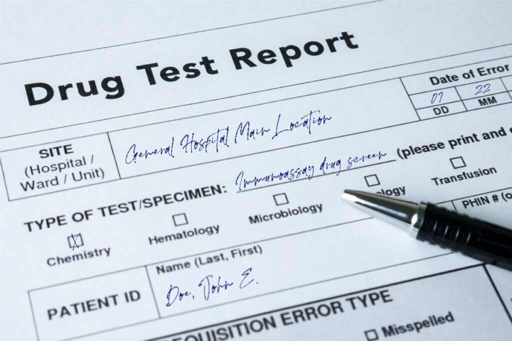 CBD Drug Test: Will Taking CBD Show Up?